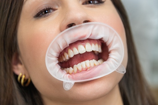 [590850WW] OptraGate pour Scanner taille "Petite" (copie)